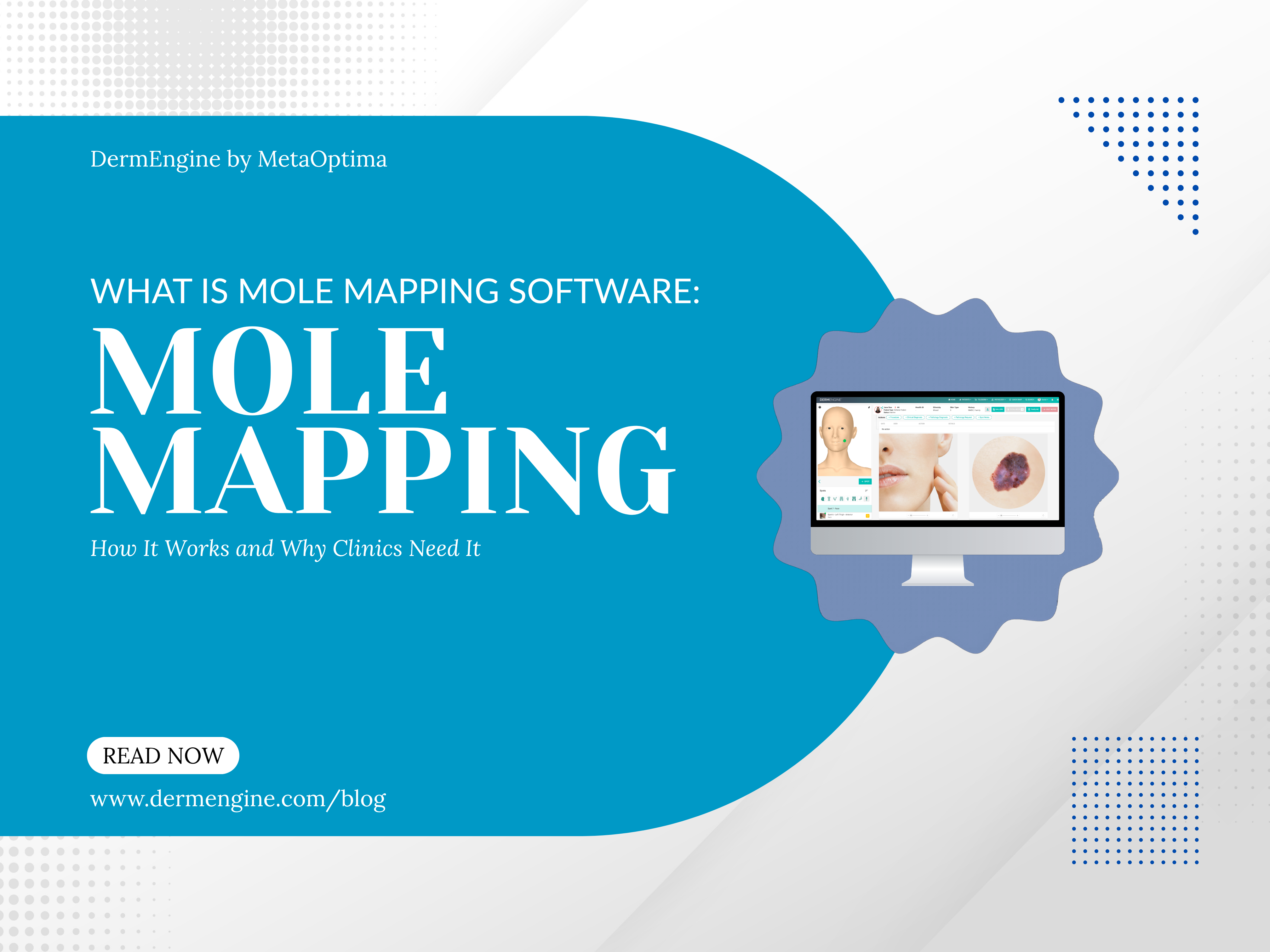 What is Mole Mapping Software: How it Works and Why Clinics Need It